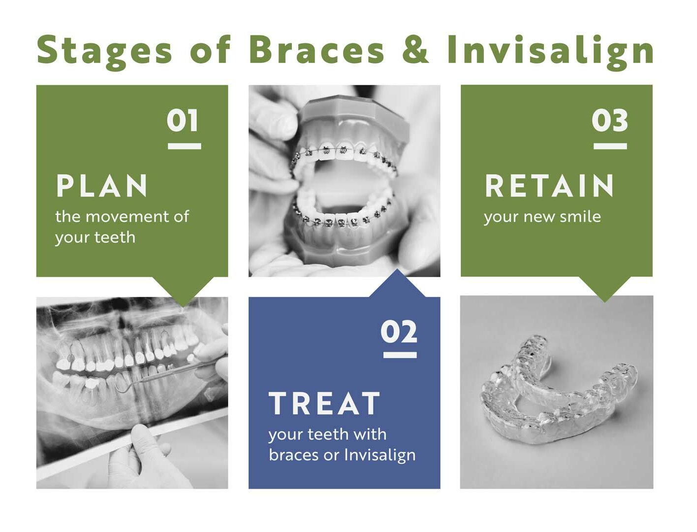 do stagesofbraces 01