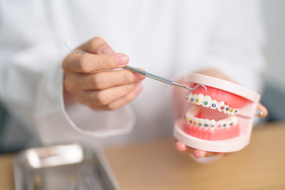 dentist,with,orthodontic,tooth,model,and,bracket,or,brace.,clean